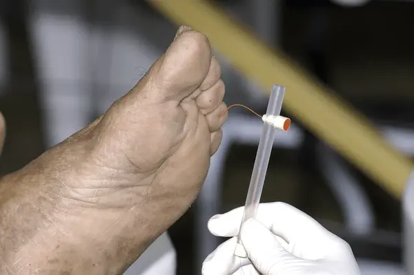 neuropathy testing near you