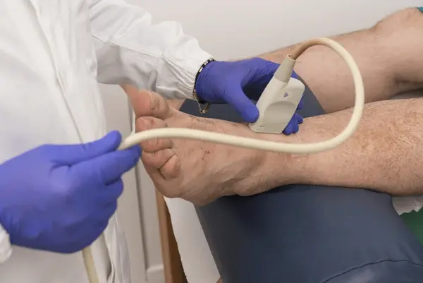 vascular testing in greater valley area