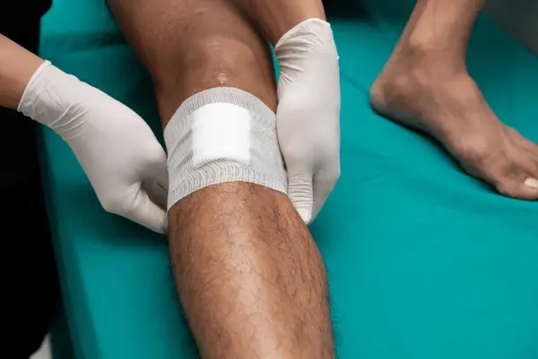 venous ulcer treatment near you