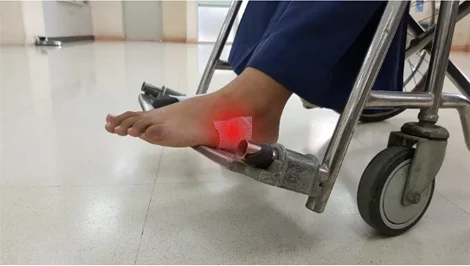 patient with ankle wrap receiving specialized foot care treatment